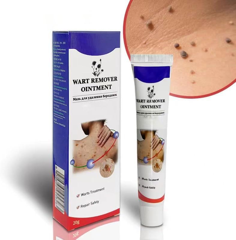 Warts Remover Ointment – مرهم إزالة الثآليل