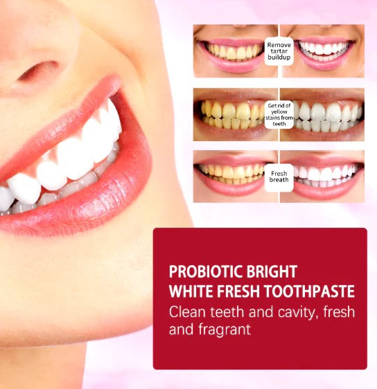 SP-4 Toothpaste – معجون الأسنان SP-4