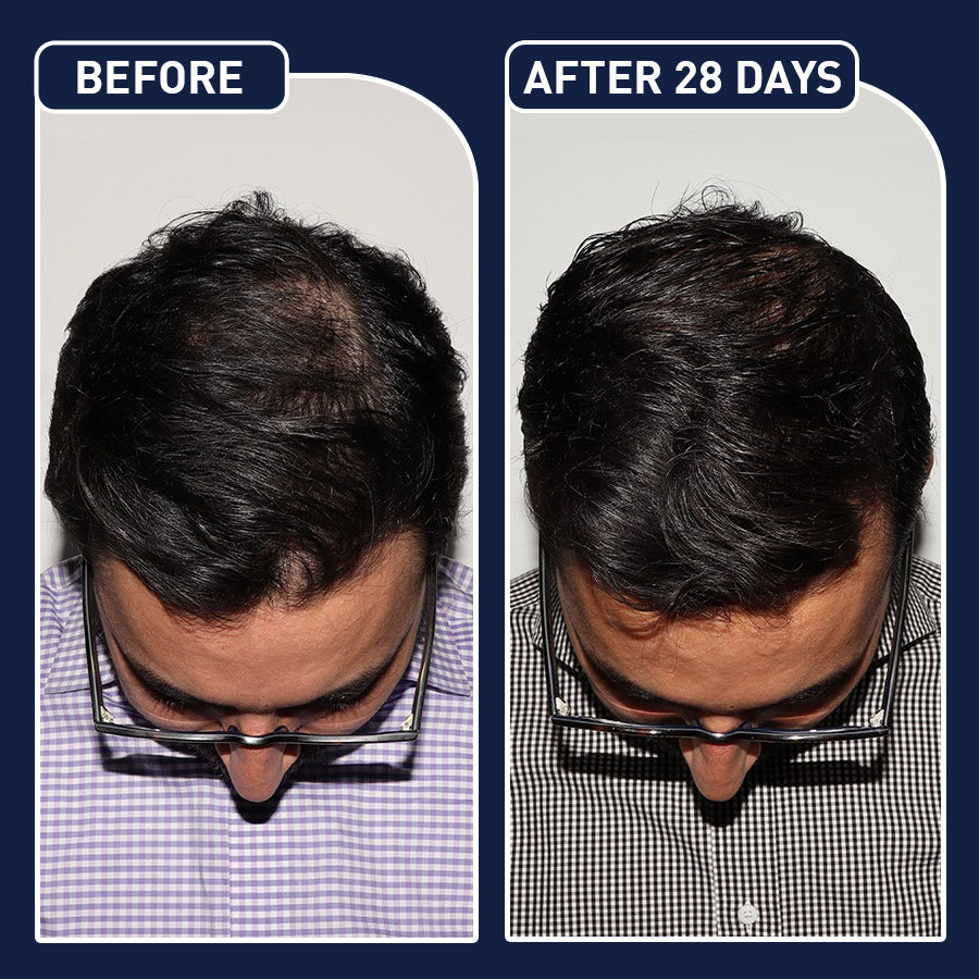 FEG Plus Hair Spray – بخاخ الشعر FEG بلس