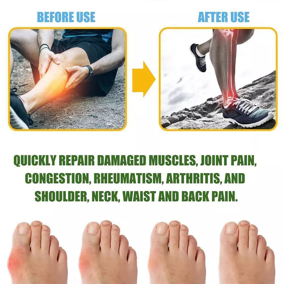 Pain Relief Spray for Athletes بخاخ مسكن للآلام للرياضيين