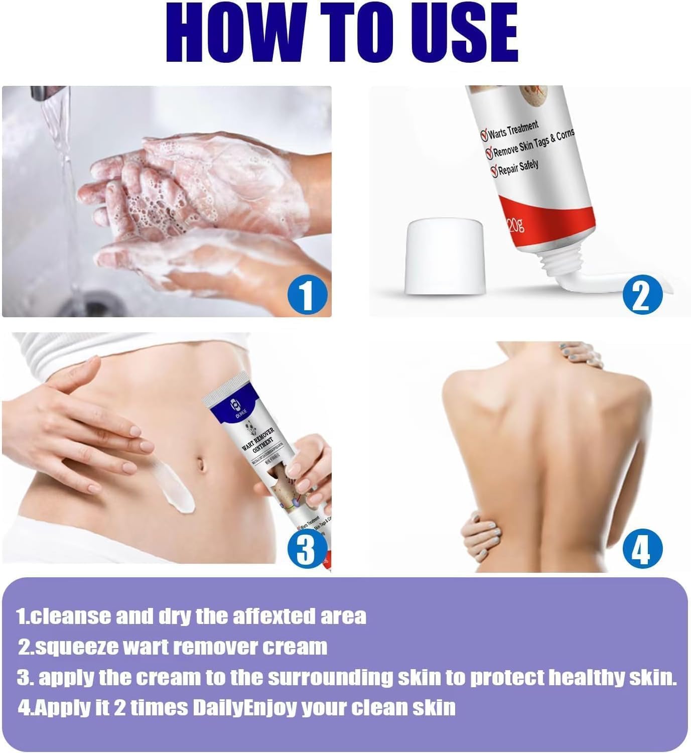 Warts Remover Ointment – مرهم إزالة الثآليل