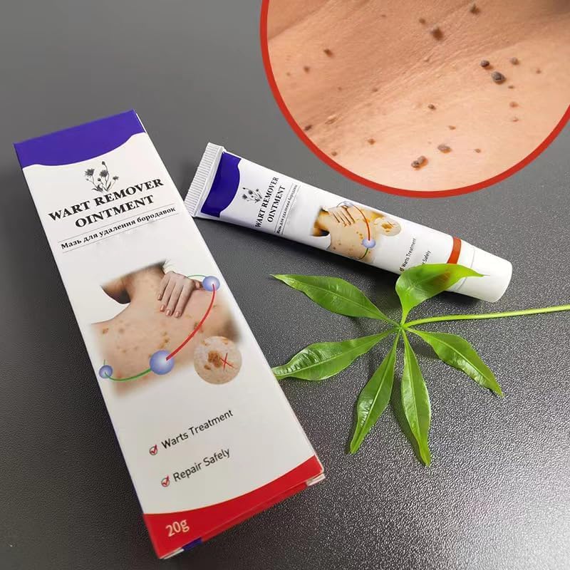 Warts Remover Ointment – مرهم إزالة الثآليل
